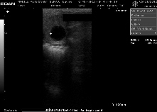 ultrasound of mare preg